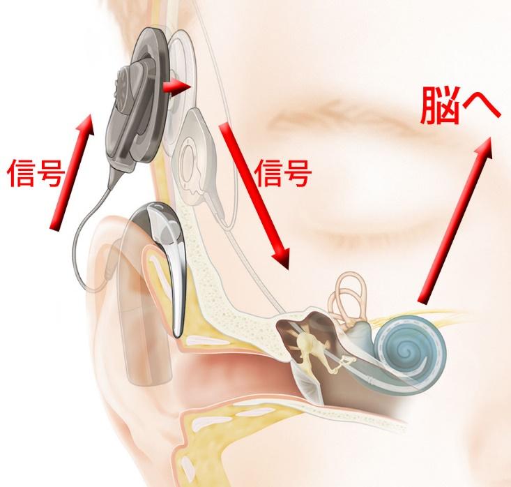 画像提供：©日本コクレア